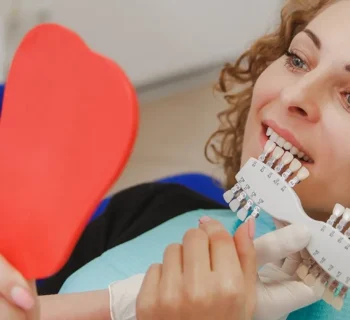 Veneers on Crooked Teeth Before and After