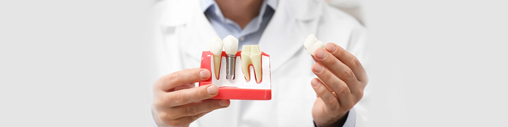 What Are the Suitable Foods for Consumption after Dental Implant Surgery?