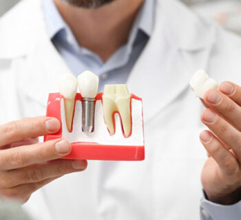 What Are the Suitable Foods for Consumption after Dental Implant Surgery?