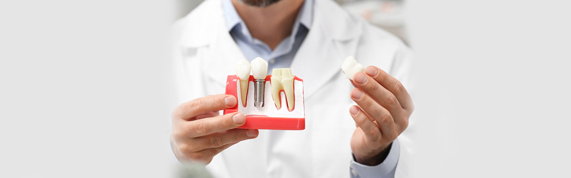 What Are the Suitable Foods for Consumption after Dental Implant Surgery?