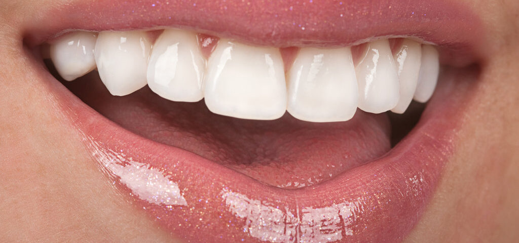 Smile Makeovers: How Veneers Can Transform Your Confidence in Just a Few Visits