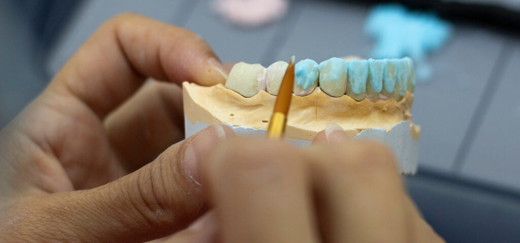 Full Mouth Reconstruction: What Woodbridge Patients Should Know Before Starting Treatment