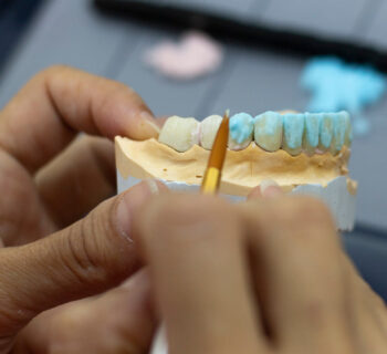 Full Mouth Reconstruction: What Woodbridge Patients Should Know Before Starting Treatment