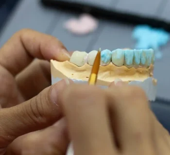 Full Mouth Reconstruction: What Woodbridge Patients Should Know Before Starting Treatment