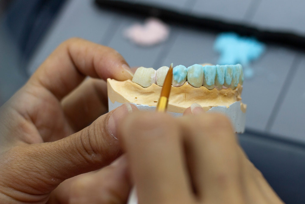 Full Mouth Reconstruction: What Woodbridge Patients Should Know Before Starting Treatment