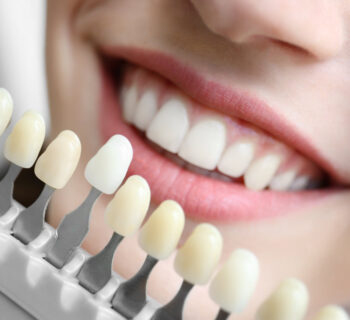 The Science Behind Modern Dental Materials: Why Quality Matters in Cosmetic Dentistry