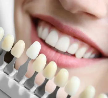 The Science Behind Modern Dental Materials: Why Quality Matters in Cosmetic Dentistry