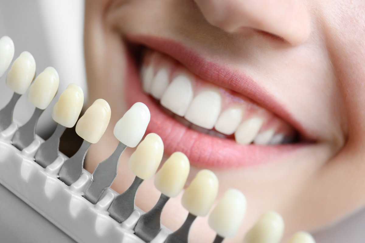The Science Behind Modern Dental Materials: Why Quality Matters in Cosmetic Dentistry