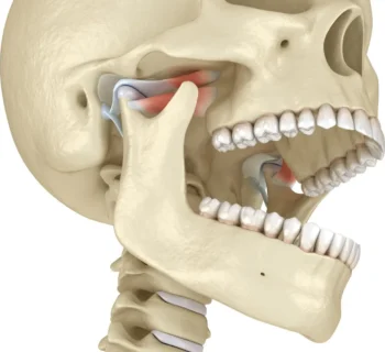 TMJ Treatment Options: When to See Your Colonia Dentist