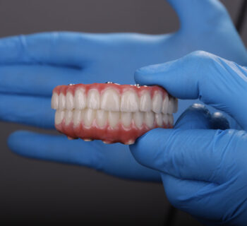 Microneedling with PRF