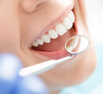 Full Mouth Rehabilitation: What Woodbridge Patients Need to Know Before Starting Treatment