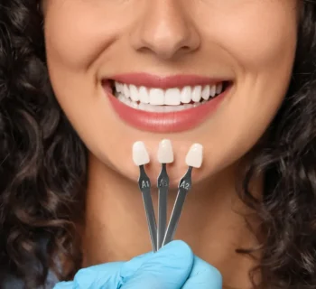 Spring Smile Makeovers: Why March is the Perfect Time to Start Your Veneer Journey
