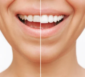 How to Choose a Cosmetic Dentist in New Jersey: Questions to Ask Before Your Consultation